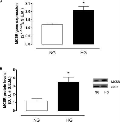 The Melanocortin MC5R as a New Target for Treatment of High Glucose-Induced Hypertrophy of the Cardiac H9c2 Cells